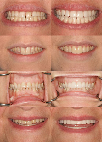 cosmetic dentistry