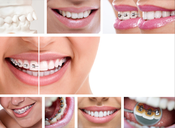 orthodontic faqs